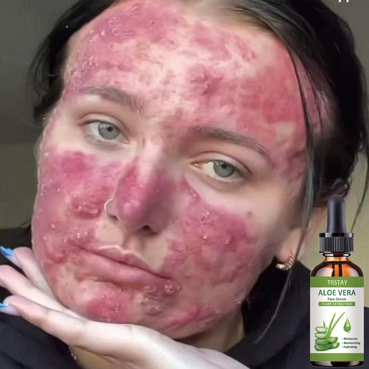 TRSTAY Aloe Vera Facial Essence with Plant Extract - Alcohol-Free Hypoallergenic Fragrance-Free Moisturizing Toner for All Light Beige Types, Soothes Irritation & Promotes Hydration, Aloe Vera Gel for Face, Skinsoothing Toner