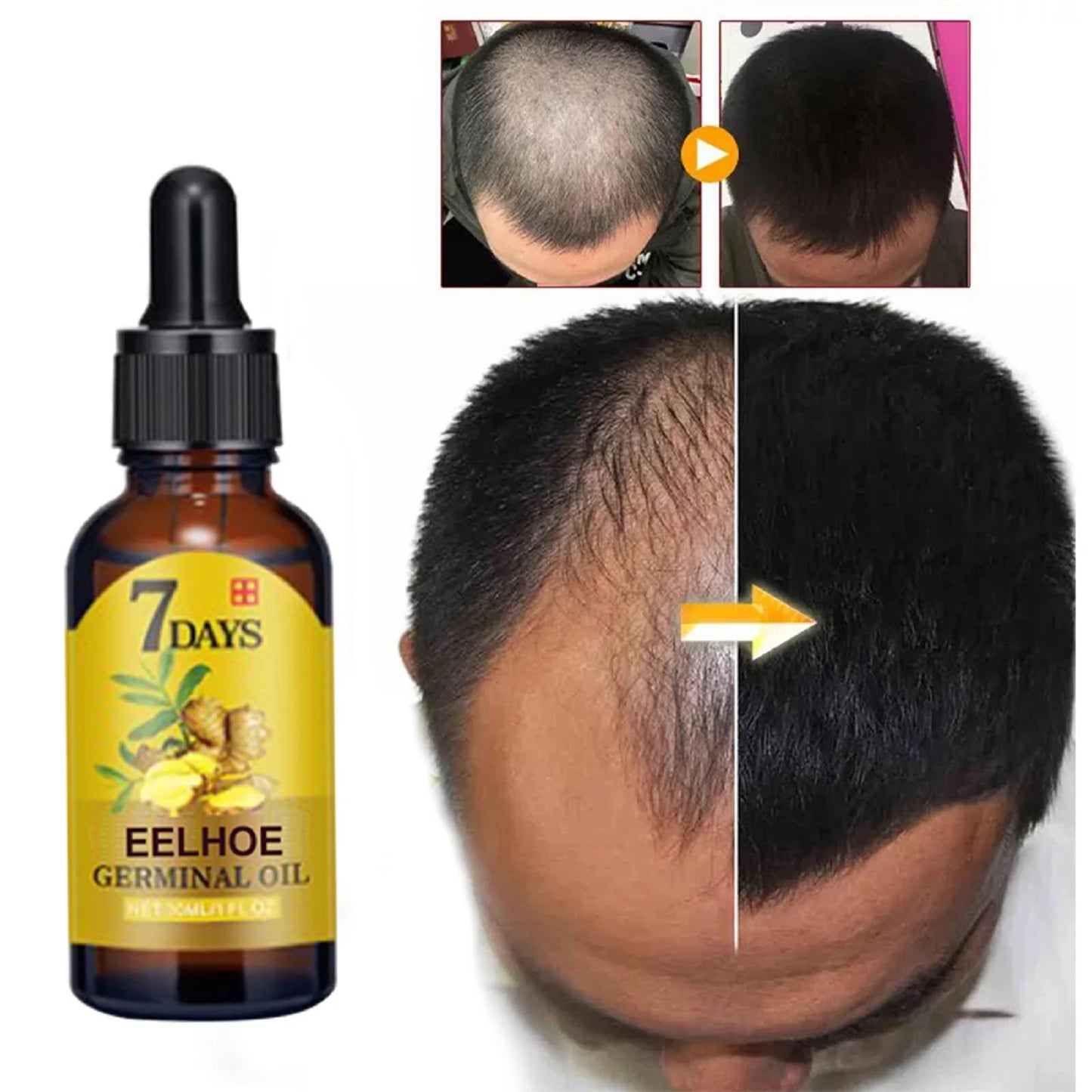 Organic Ginger Hair Care Oil Hair Roots Scalp Treatment Improve Androgenetic Alopecia Scalp Treatment Serum Strengthen Hair Roots