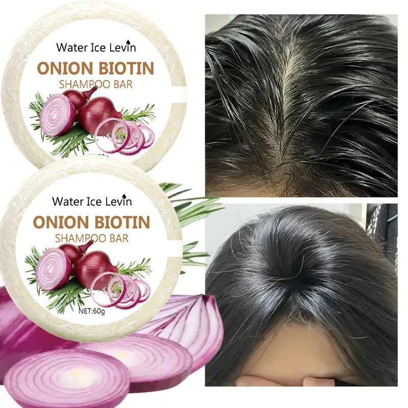 Organic Onion and Biotin Shampoo Soap - 60g, Suitable for All Hair Types, Moisturizing and Smoothing, Rich in Rosemary Extract