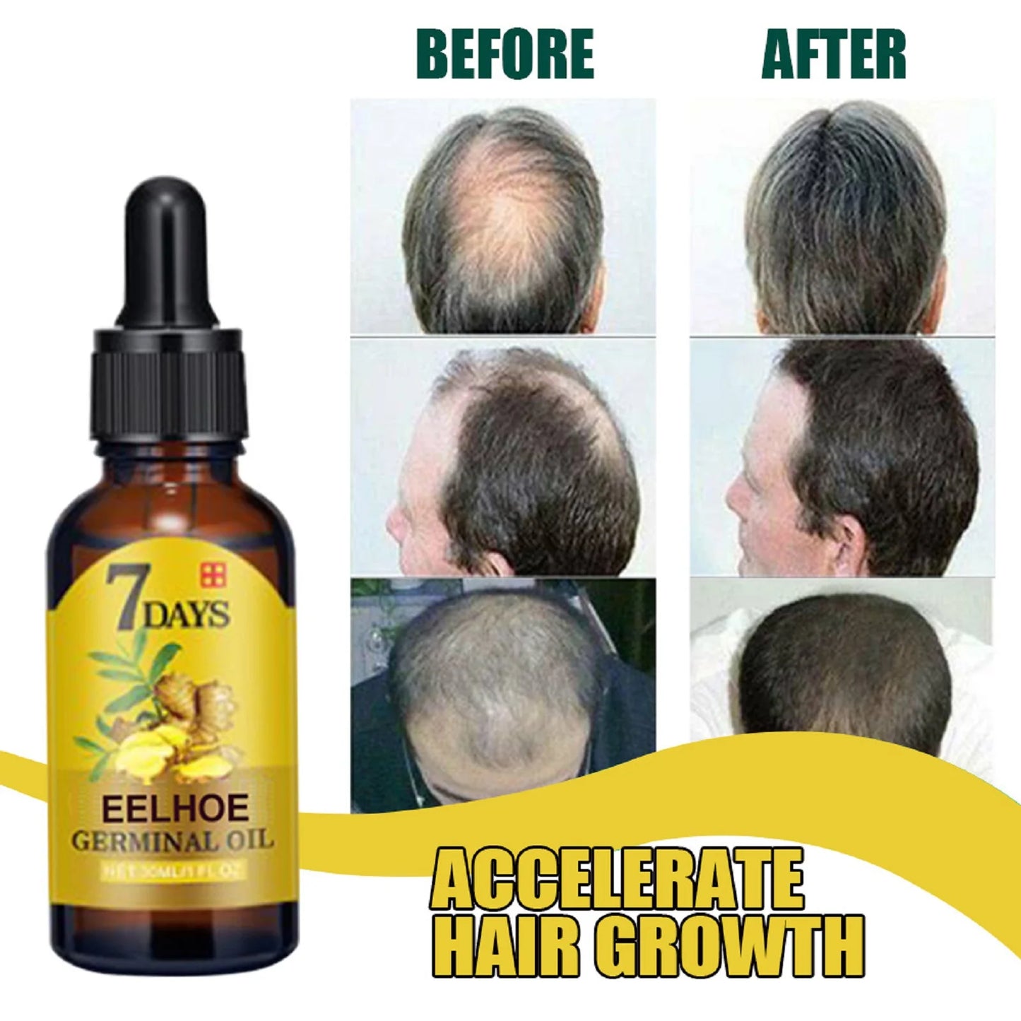 Organic Ginger Hair Care Oil Hair Roots Scalp Treatment Improve Androgenetic Alopecia Scalp Treatment Serum Strengthen Hair Roots