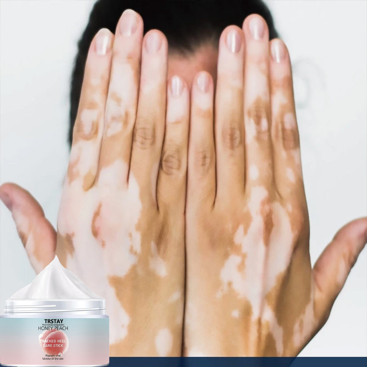 Peach Foot Cream, made from plant extracts, gently moisturizes and cares for hands and feet. Cleverly designed and consistently used, it leaves your feet soft and smooth