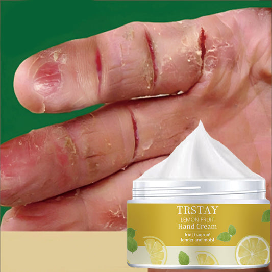 TRSTAY Lemon Fruit Hand & Foot Cream - Gentle Hypoallergenic Formula for Dry, Cracked Light Beige, Daily Moisturizer with Soothing Lemon Fruit Extract, 1.7oz, All Light Beige Types Including Sensitive, Fresh Appeal Packaging,